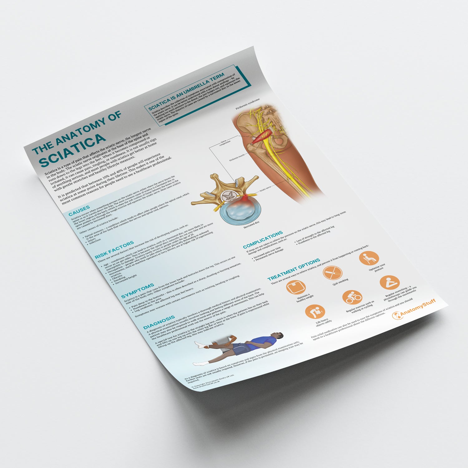 The Anatomy of Sciatica Chart / Poster