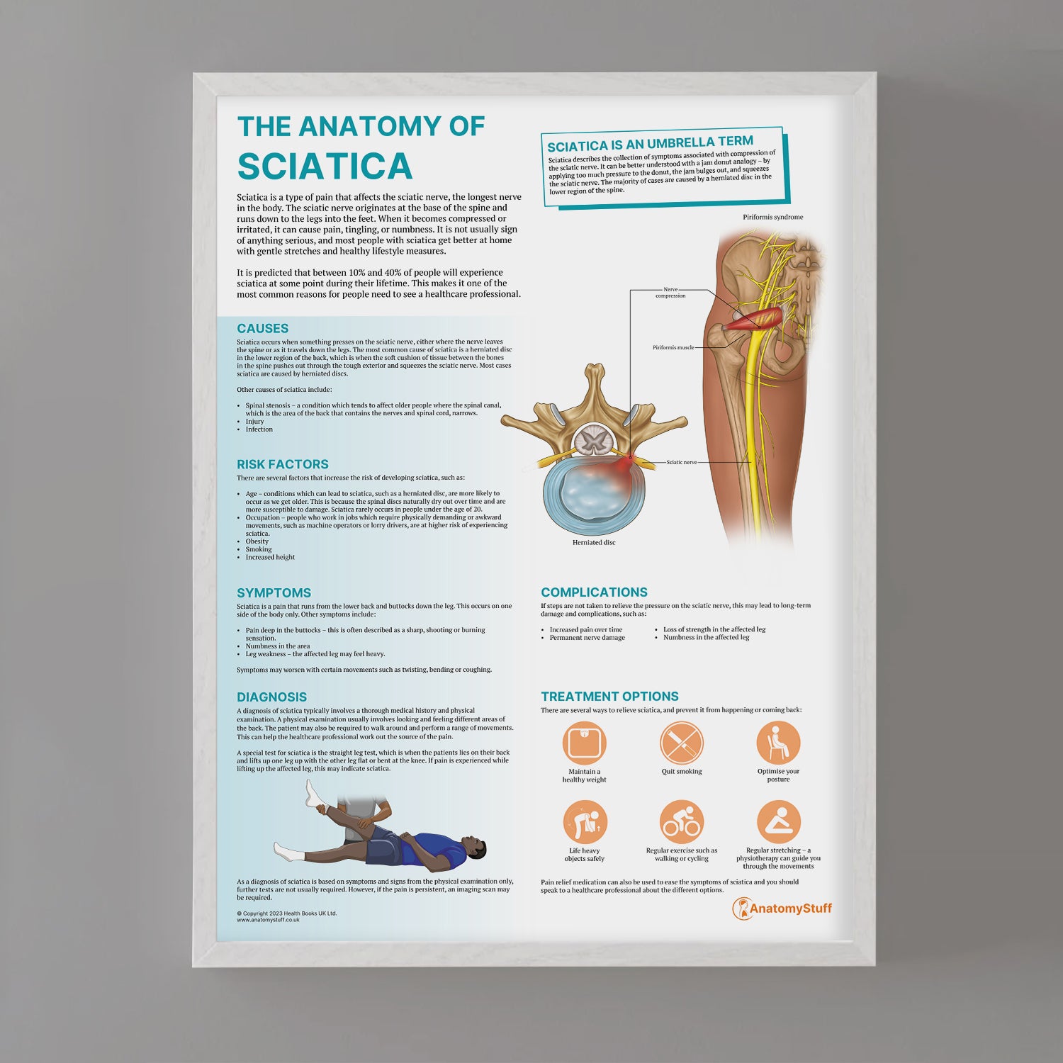 The Anatomy of Sciatica Chart / Poster