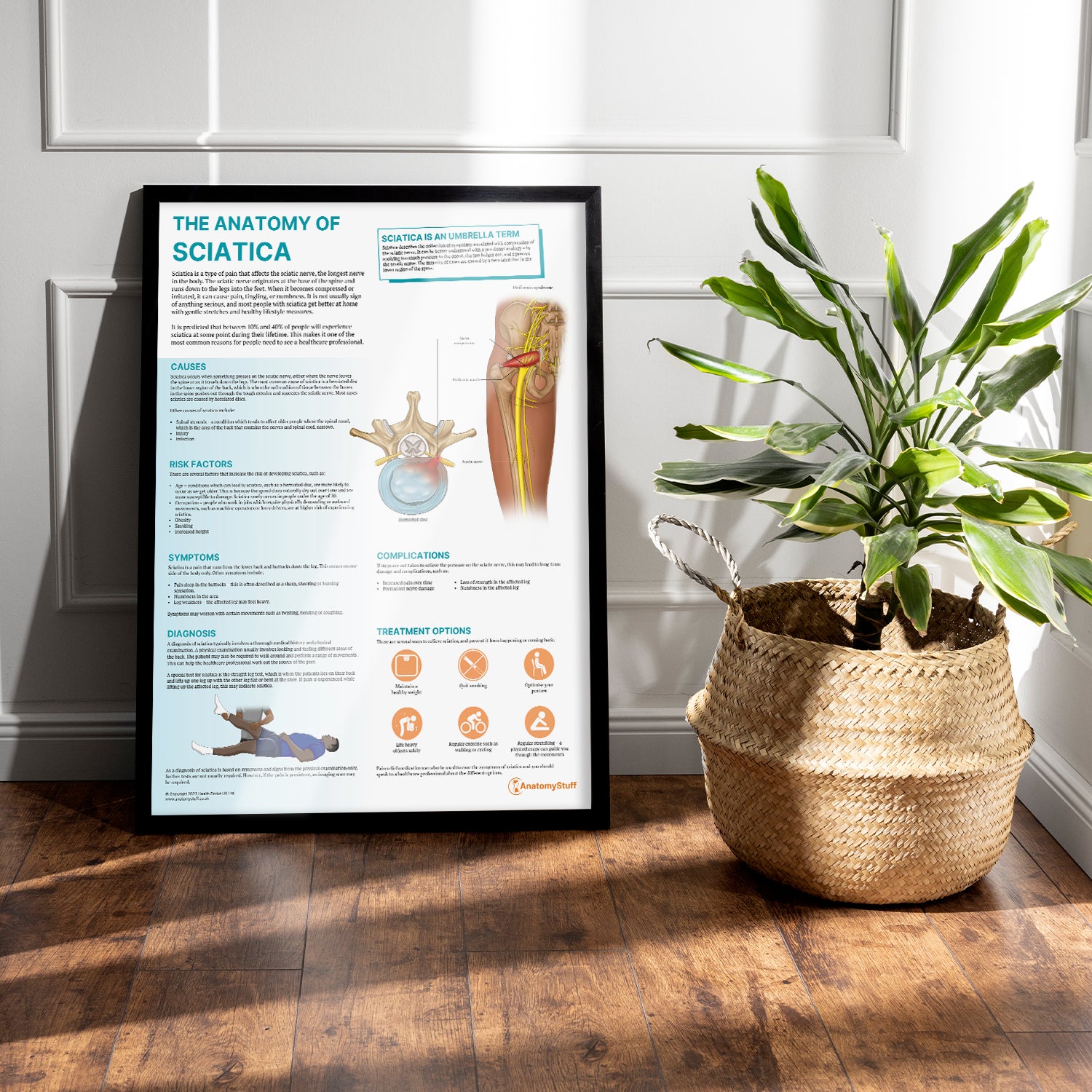 The Anatomy of Sciatica Chart / Poster