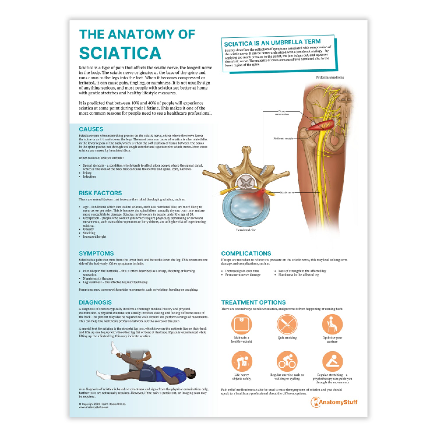 The Anatomy of Sciatica Chart / Poster