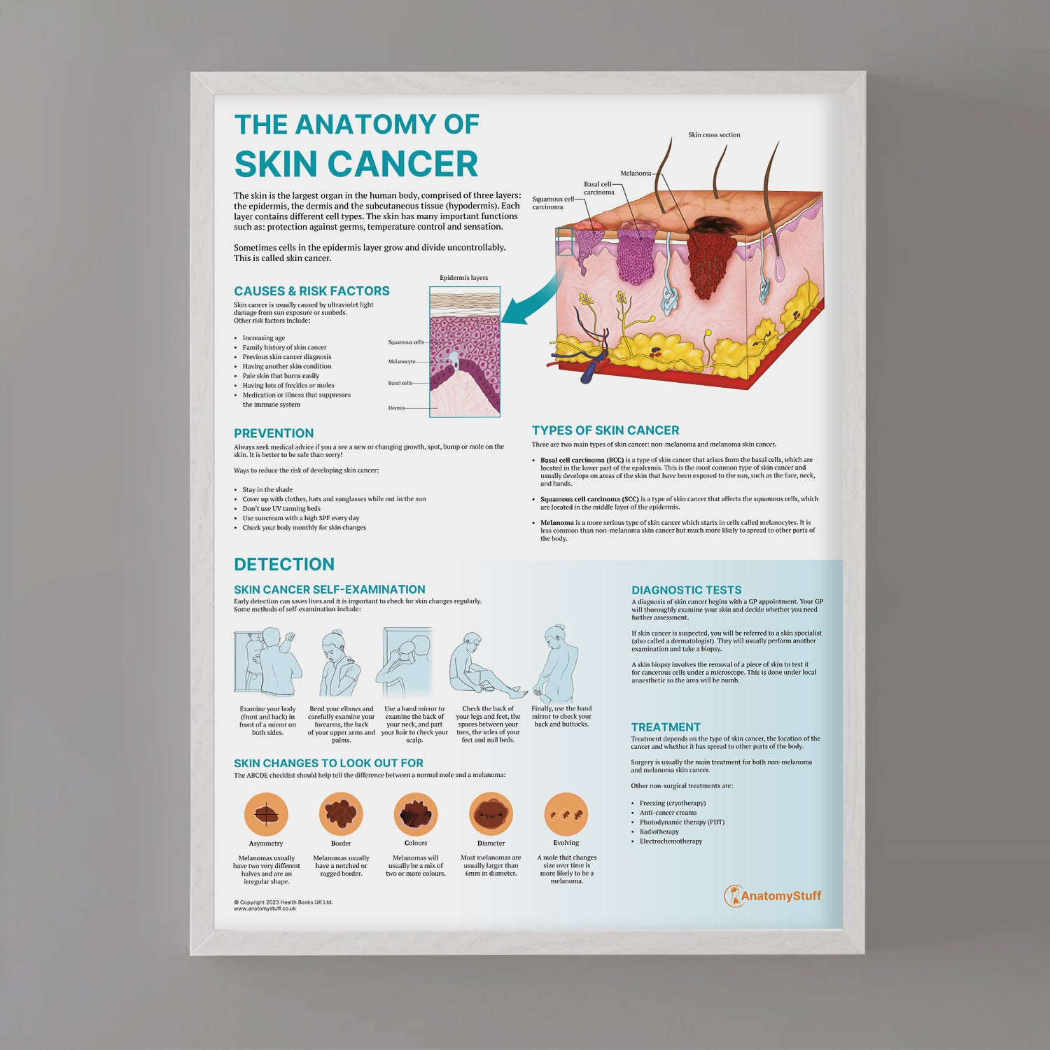 The Anatomy of Skin Cancer Chart / Poster