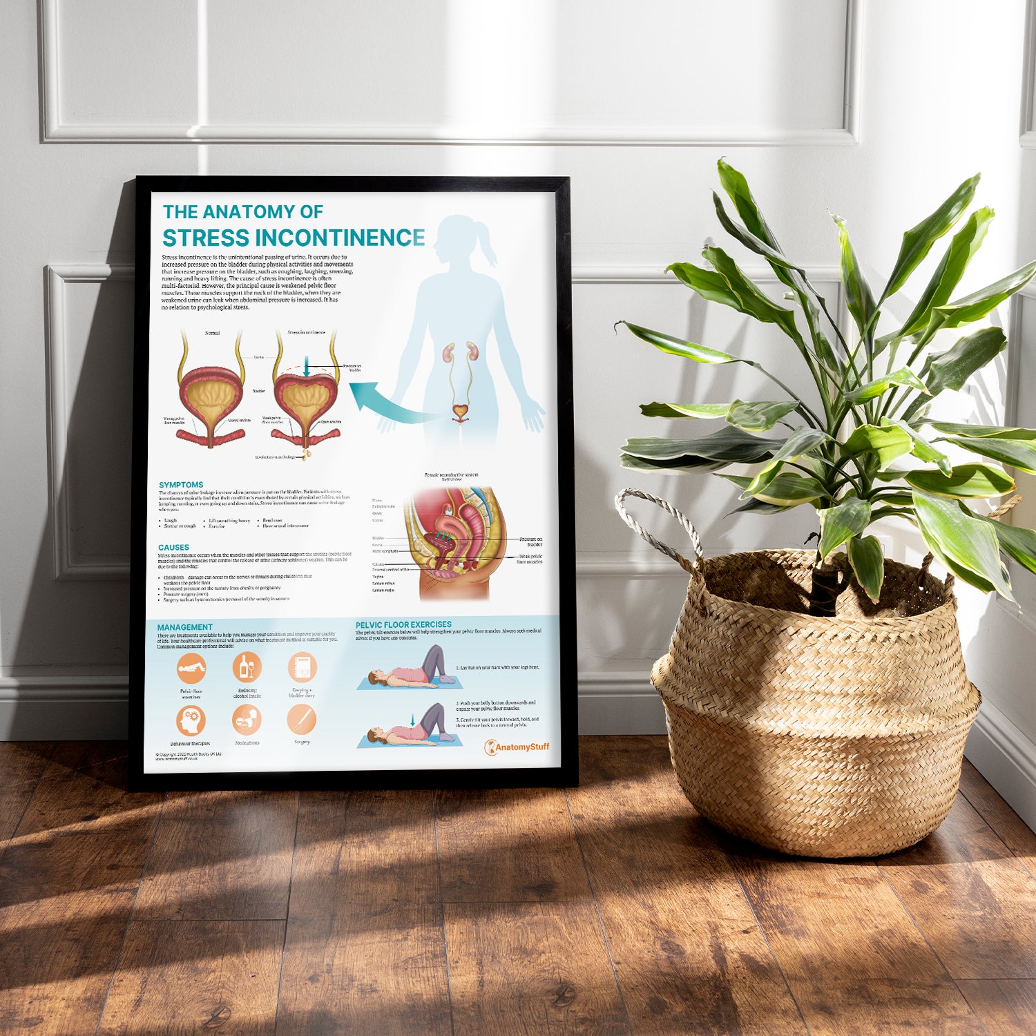 The Anatomy of Stress Incontinence Chart / Poster