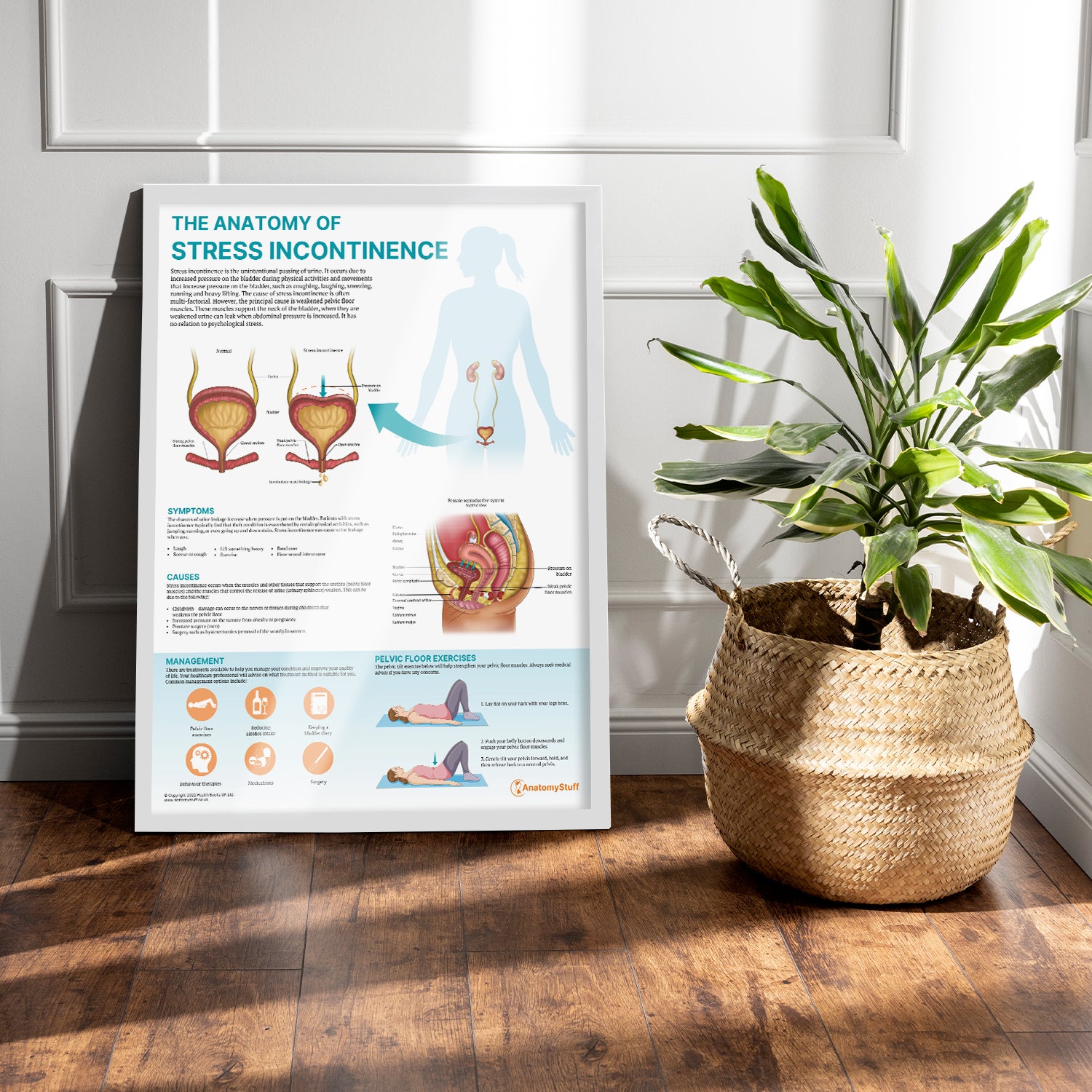 The Anatomy of Stress Incontinence Chart / Poster