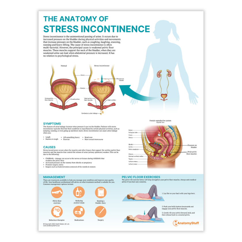 The Anatomy of Stress Incontinence Chart / Poster