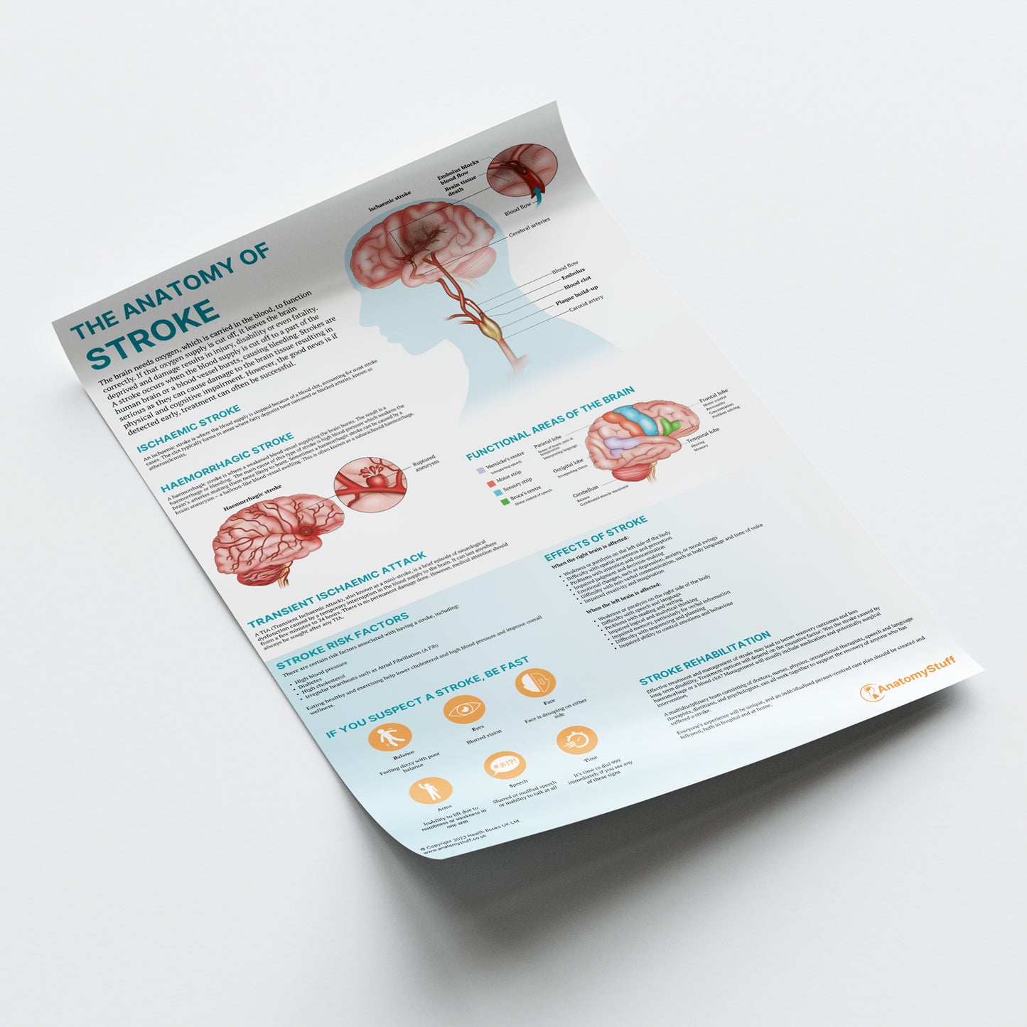 The Anatomy of Stroke Chart / Poster