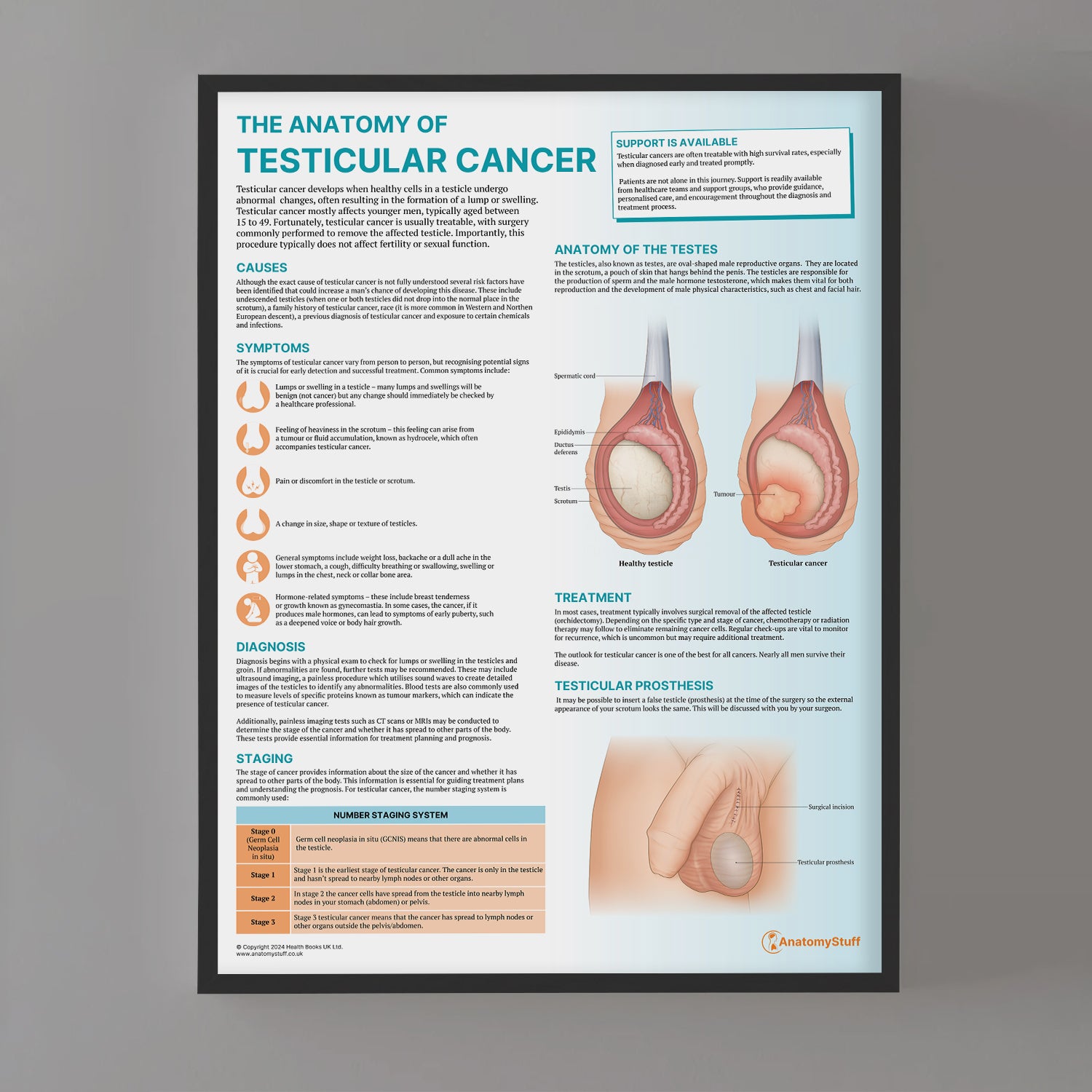 The Anatomy of Testicular Cancer Chart / Poster
