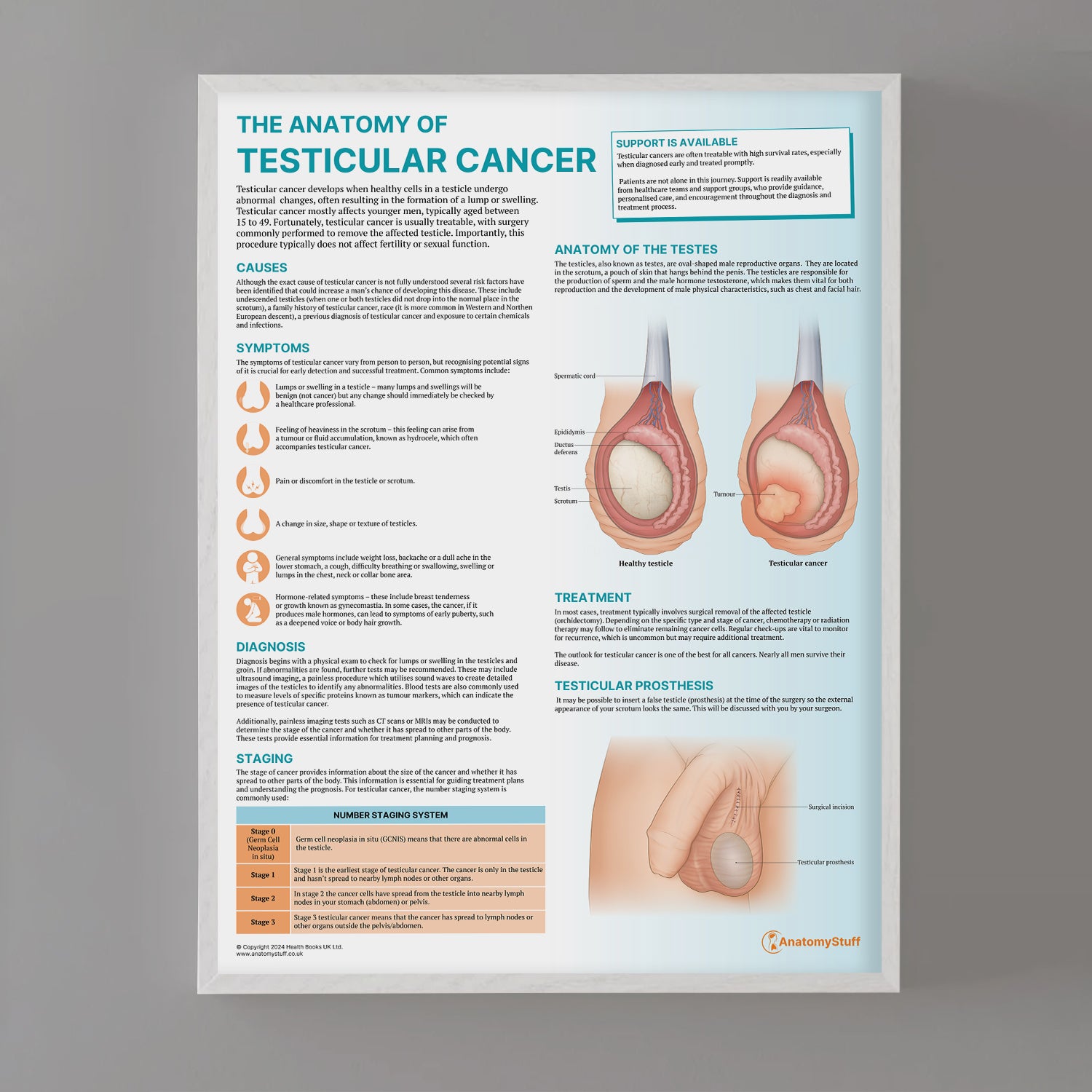 The Anatomy of Testicular Cancer Chart / Poster