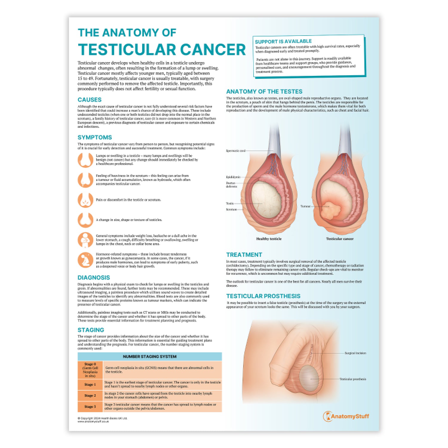 The Anatomy of Testicular Cancer Chart / Poster