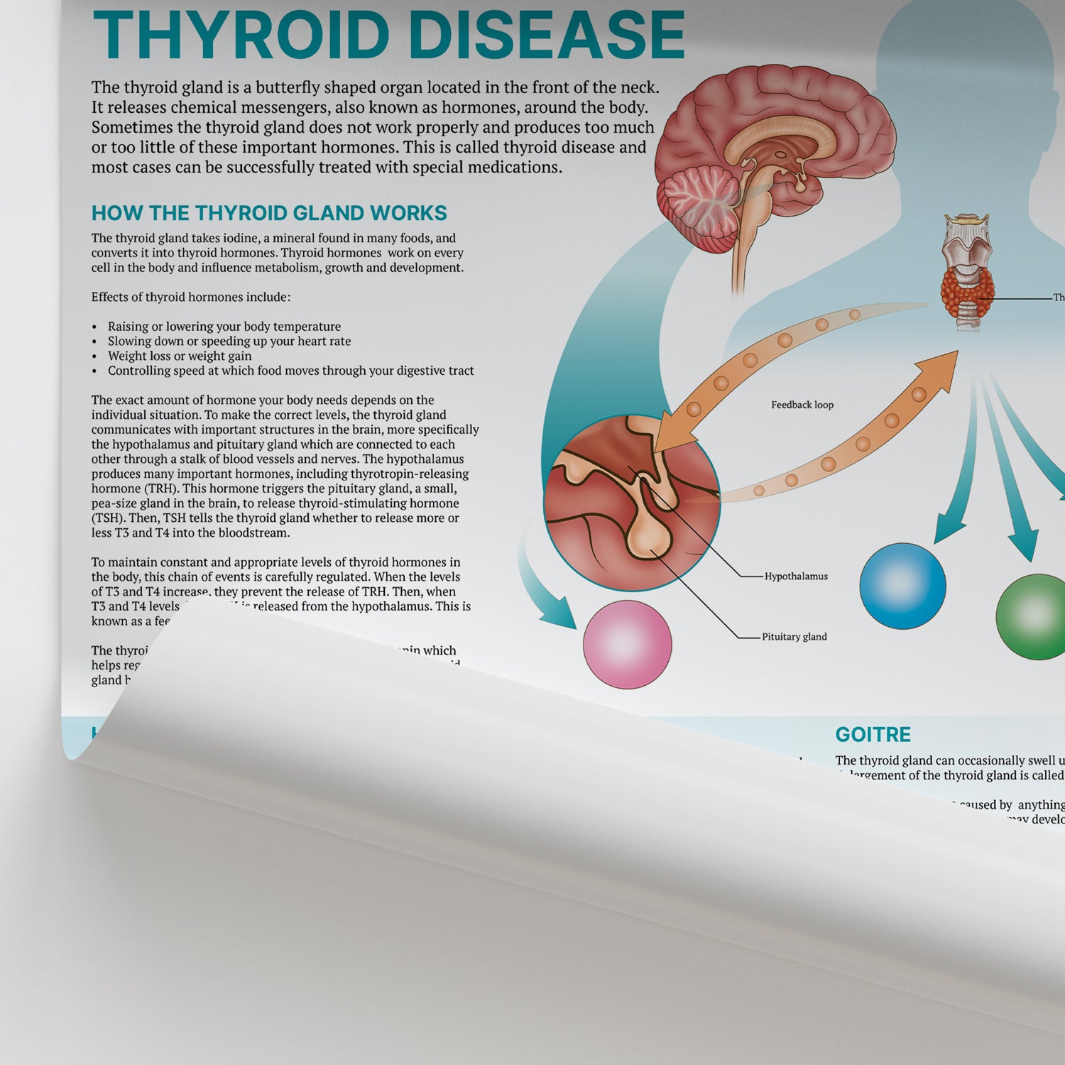 The Anatomy of Thyroid Disease Chart / Poster