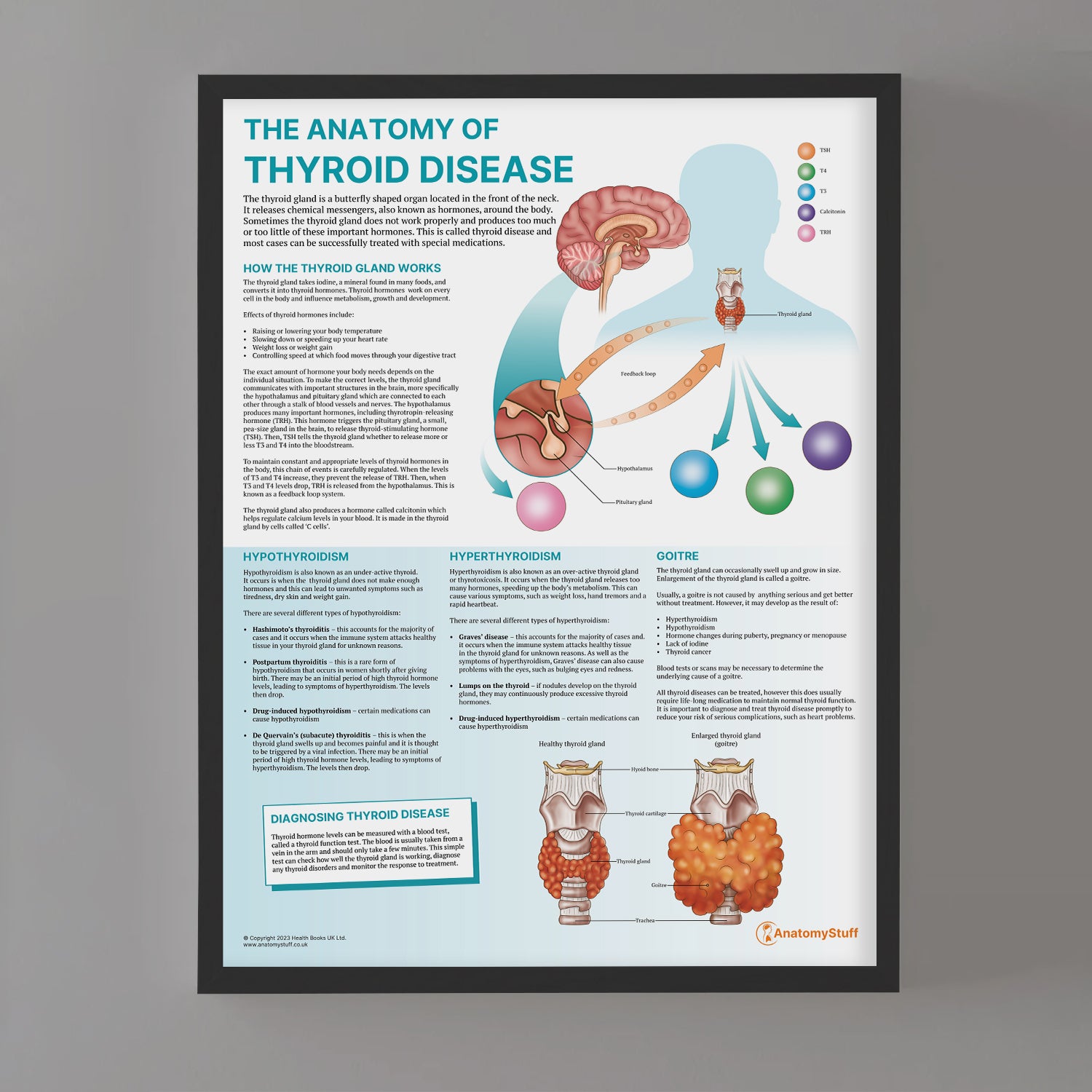 The Anatomy of Thyroid Disease Chart / Poster