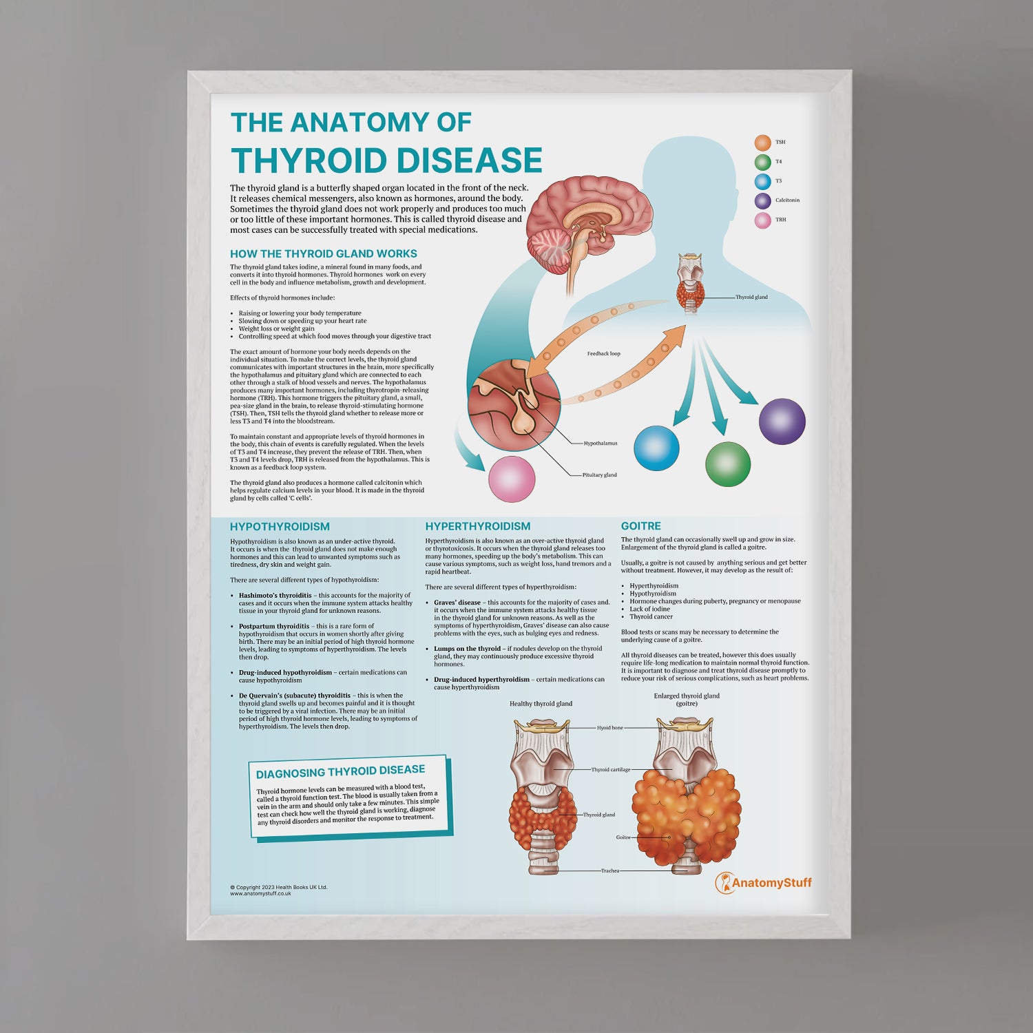 The Anatomy of Thyroid Disease Chart / Poster