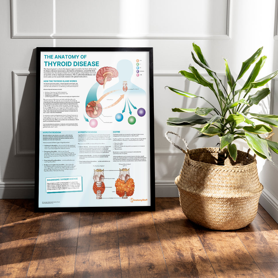 The Anatomy of Thyroid Disease Chart / Poster