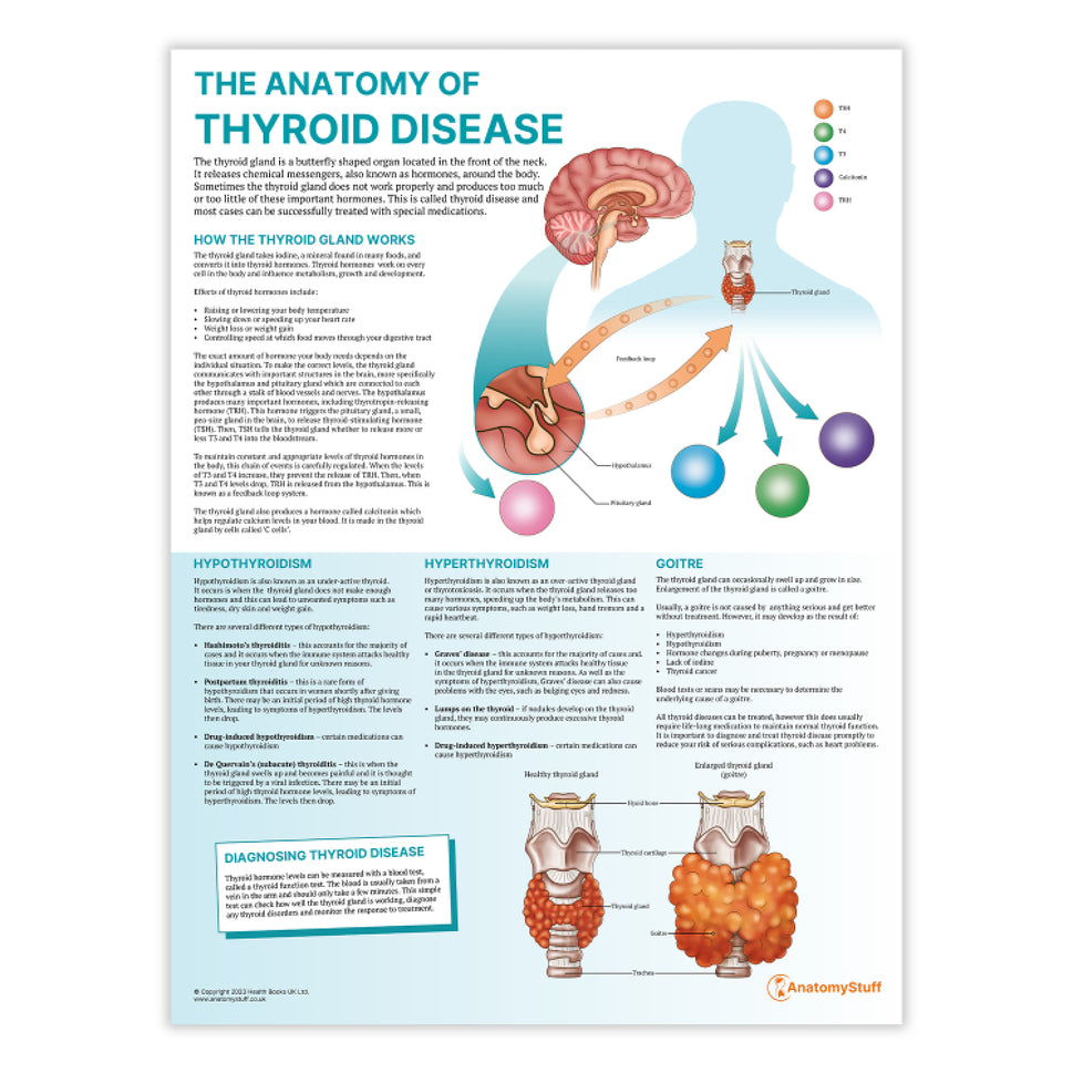 The Anatomy of Thyroid Disease Chart / Poster