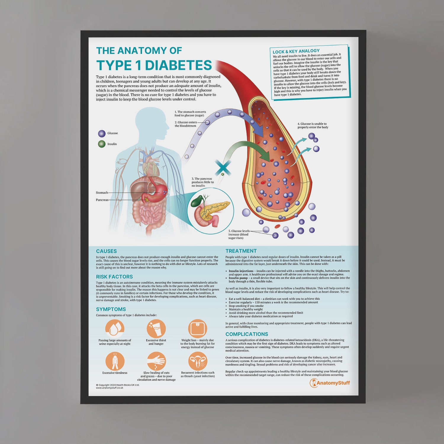 The Anatomy of Type 1 Diabetes Chart / Poster