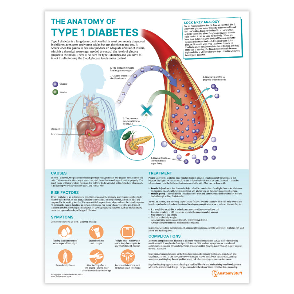 The Anatomy of Type 1 Diabetes Chart / Poster