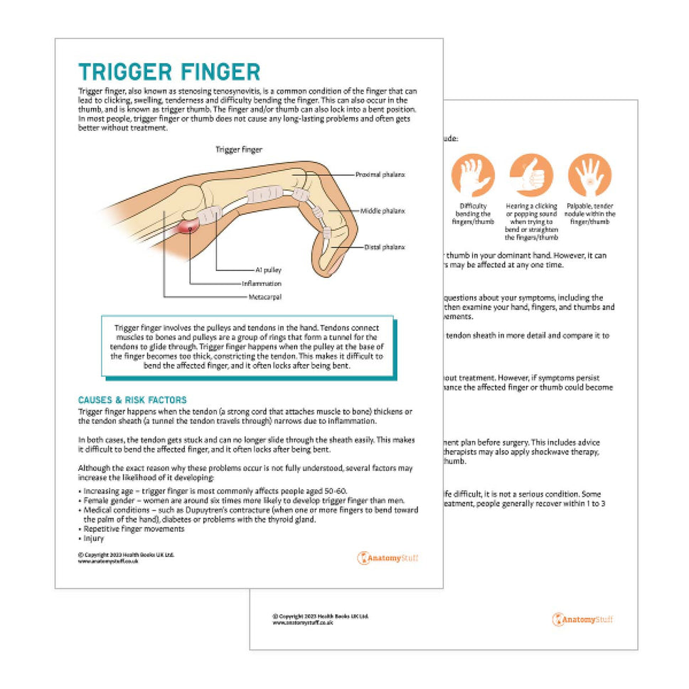 Trigger Finger Patient Education Handout (Printable PDF)
