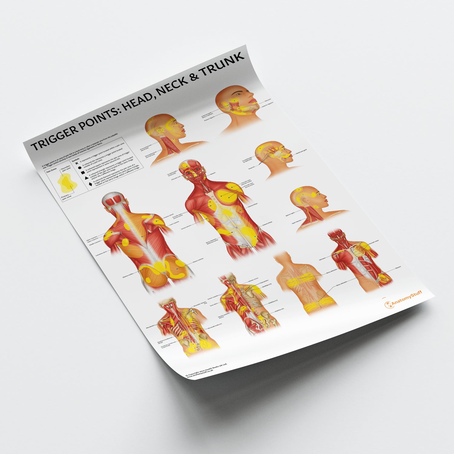 Trigger Points: Head, Neck & Trunk Chart / Poster