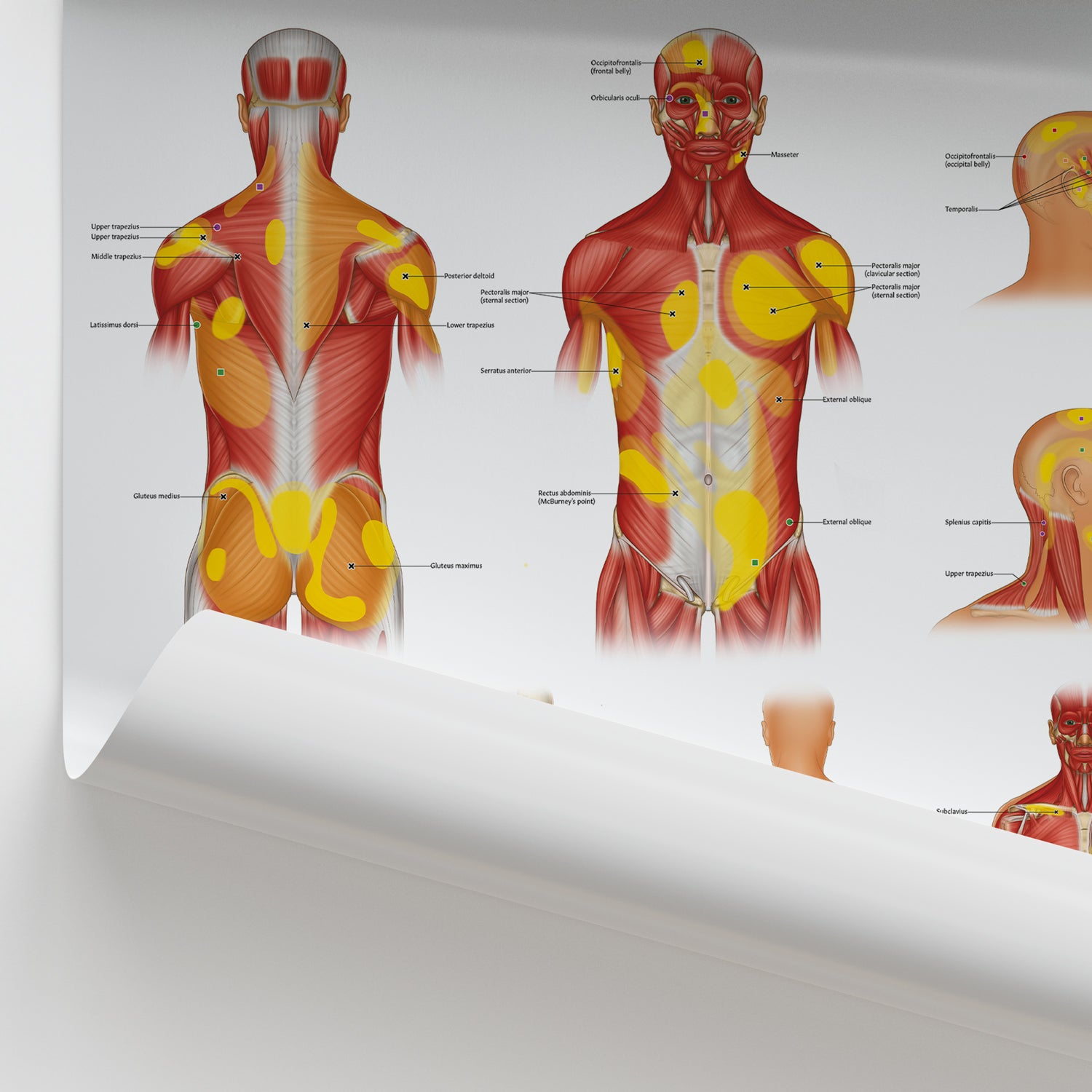 Trigger Points: Head, Neck & Trunk Chart / Poster
