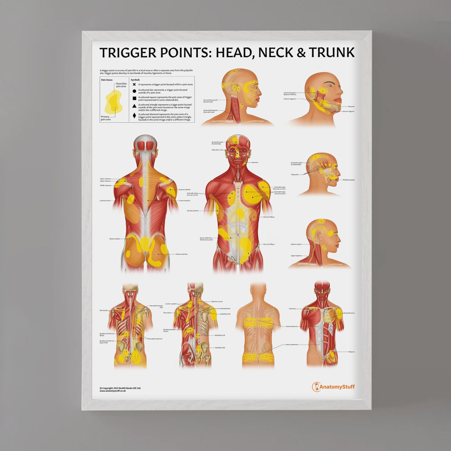 Trigger Points: Head, Neck & Trunk Chart / Poster
