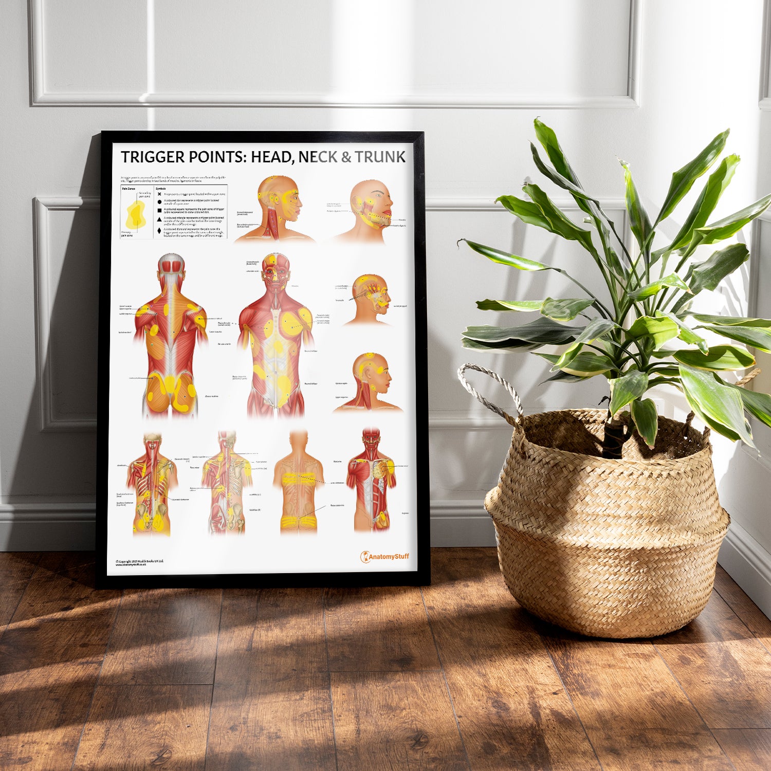 Trigger Points: Head, Neck & Trunk Chart / Poster