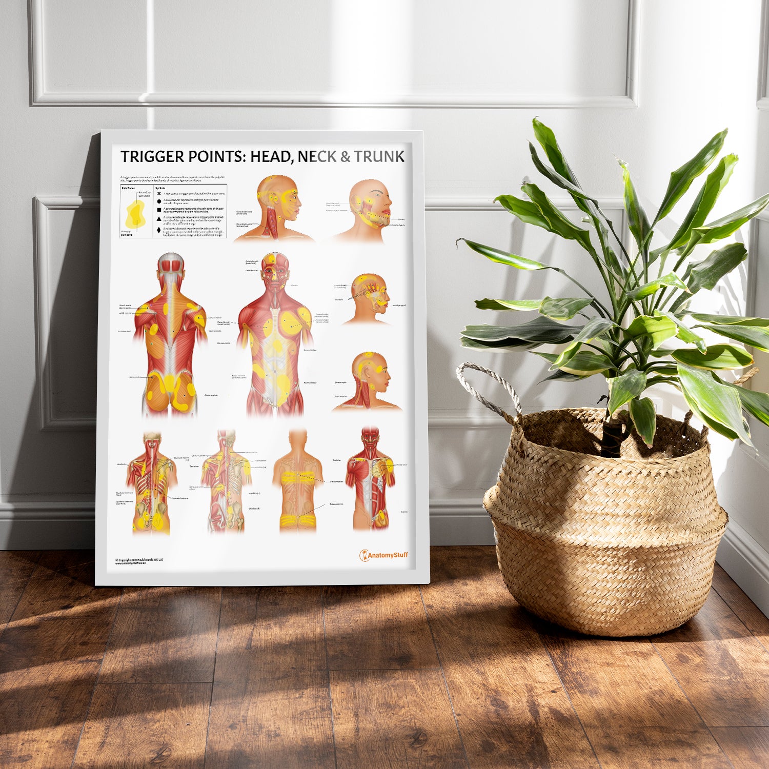 Trigger Points: Head, Neck & Trunk Chart / Poster