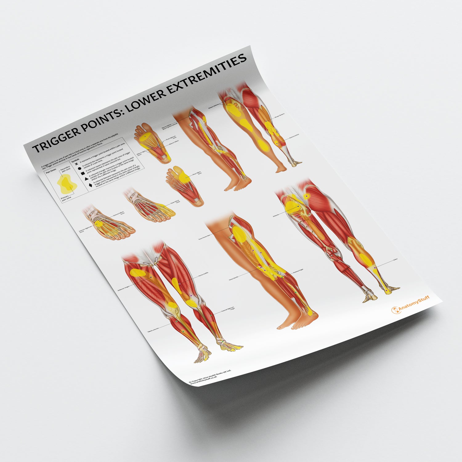 Trigger Points: Lower Extremities Chart / Poster