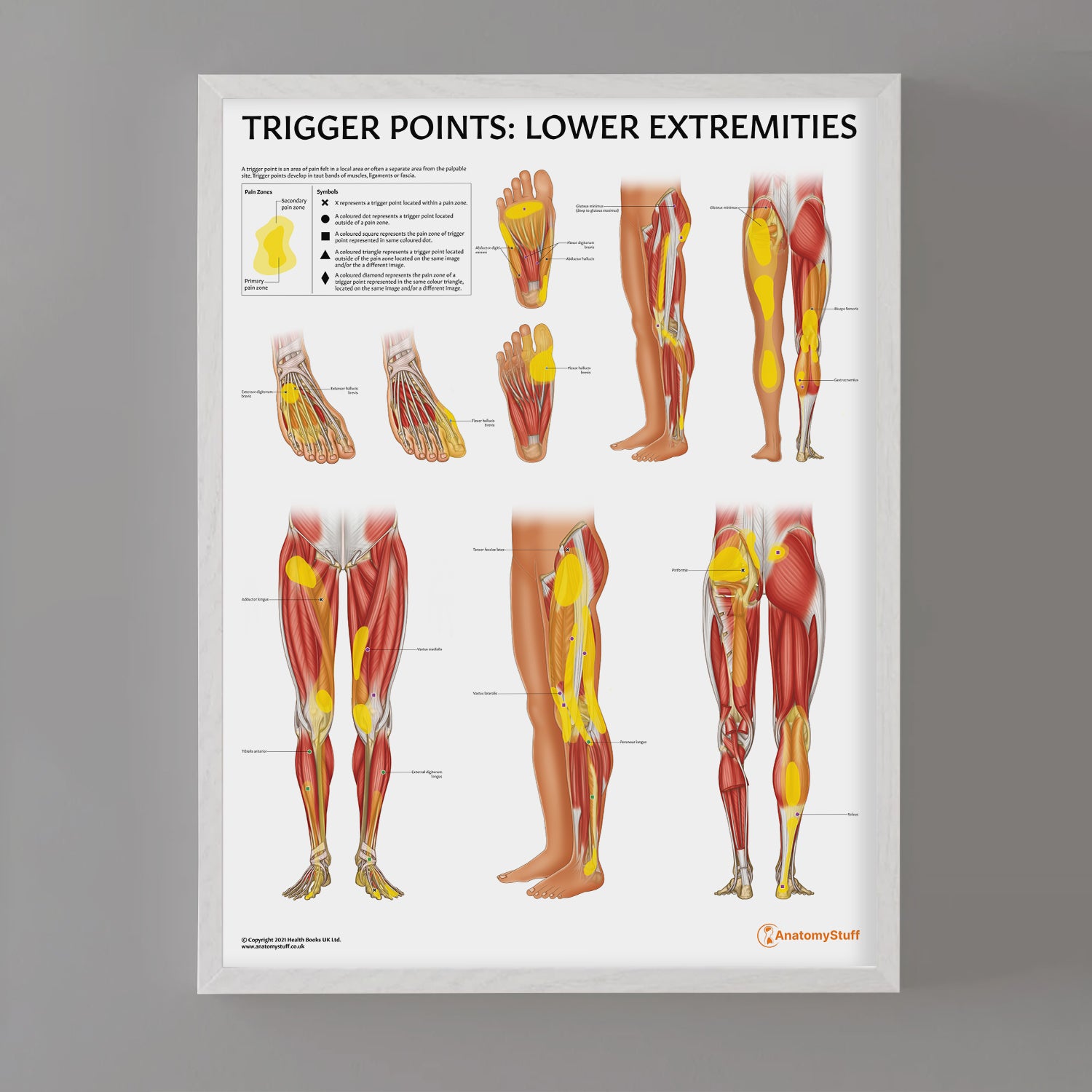 Trigger Points: Lower Extremities Chart / Poster