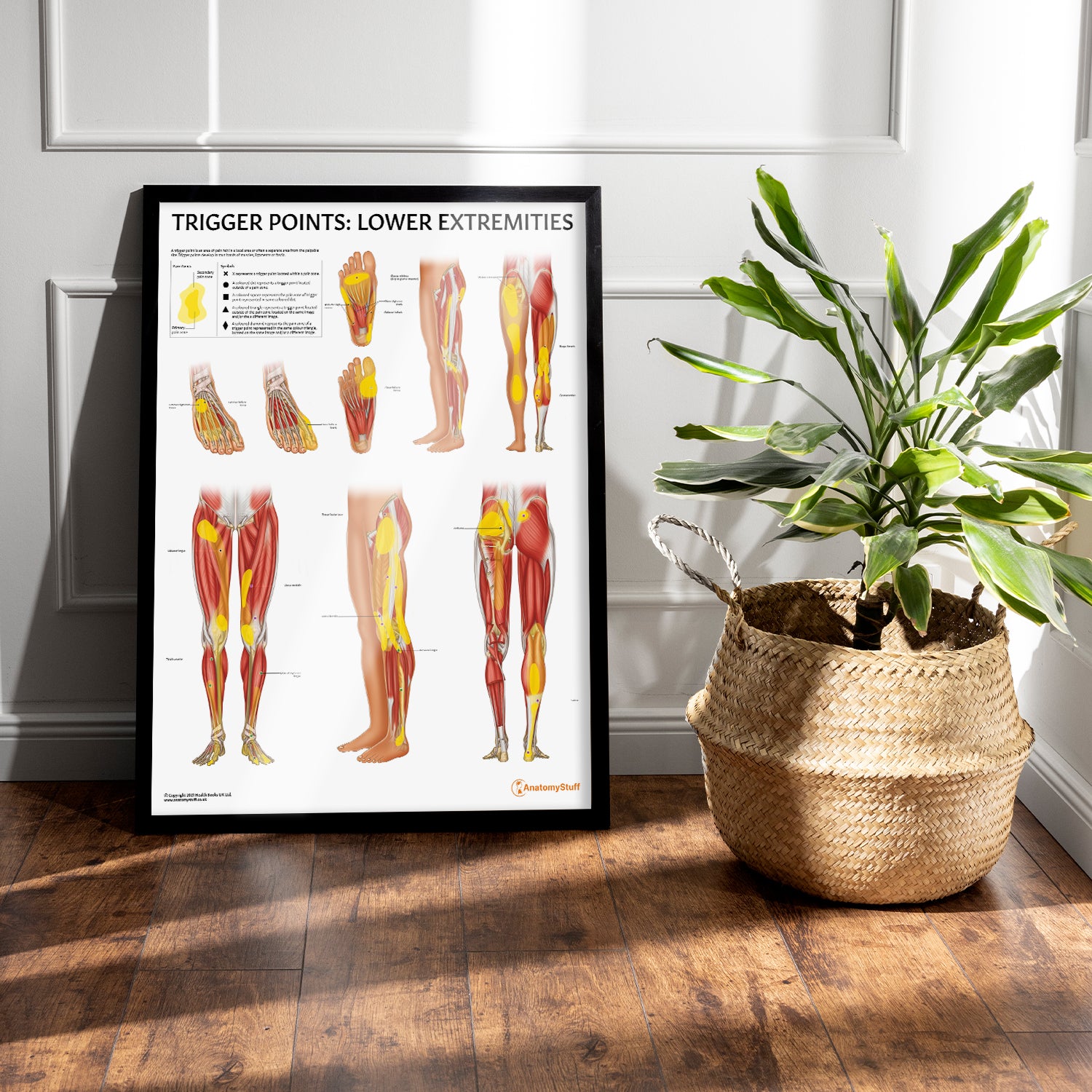 Trigger Points: Lower Extremities Chart / Poster