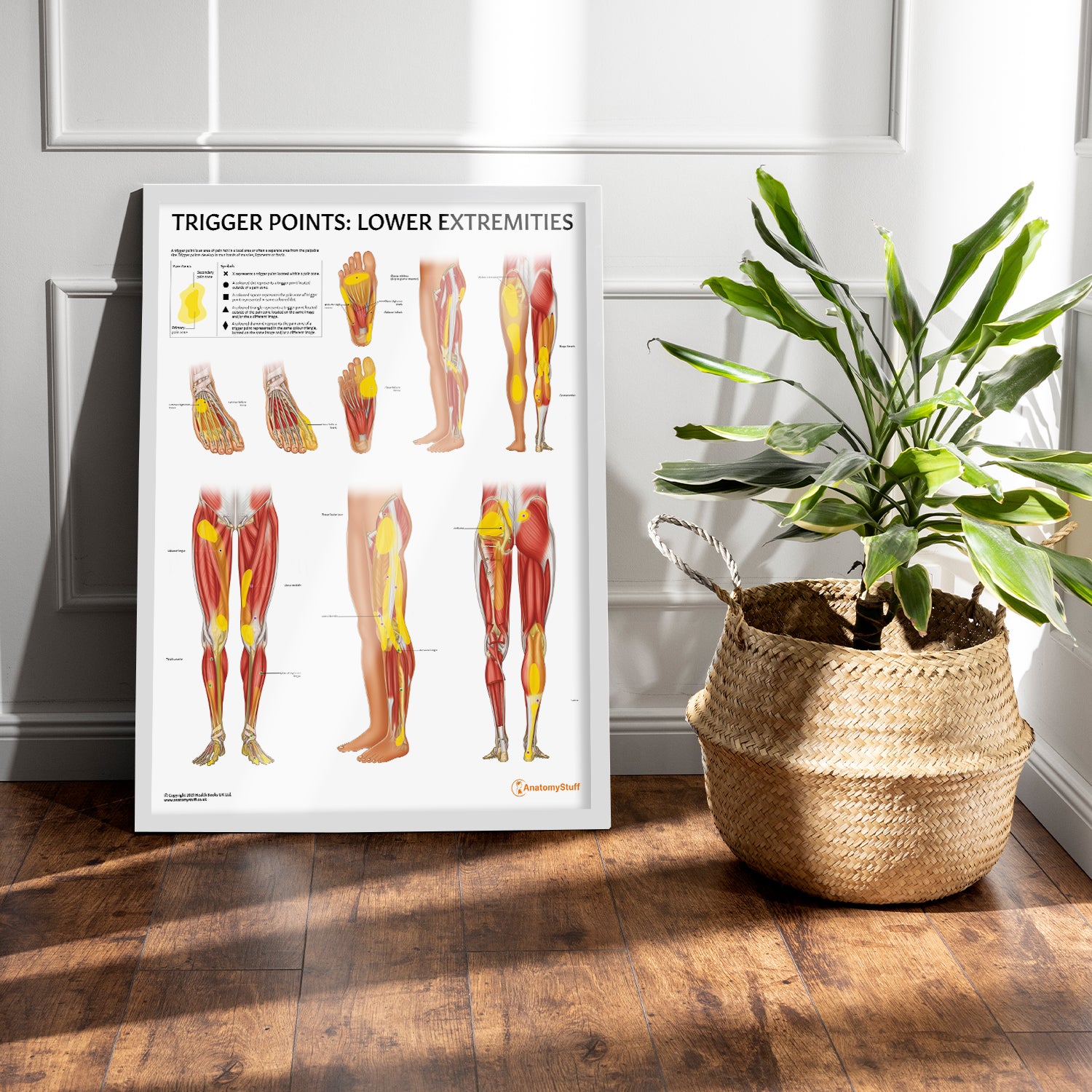 Trigger Points: Lower Extremities Chart / Poster