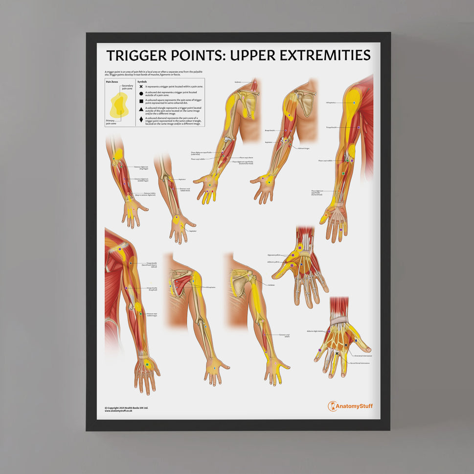 Trigger Points: Upper Extremities Chart / Poster