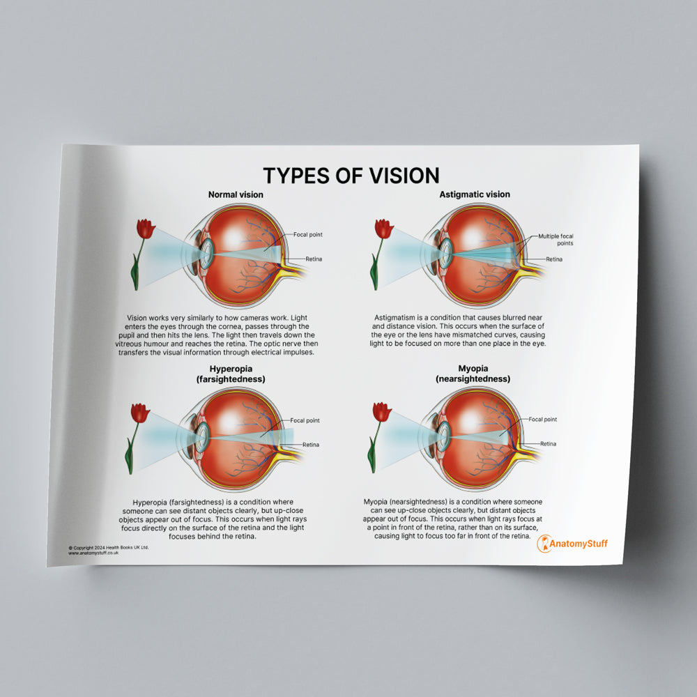 Types of Vision (Printable PDF)