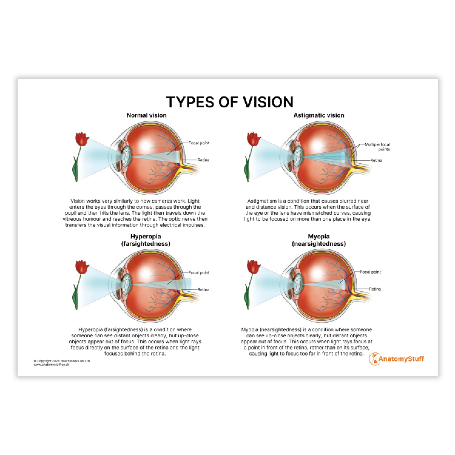 Types of Vision (Printable PDF)
