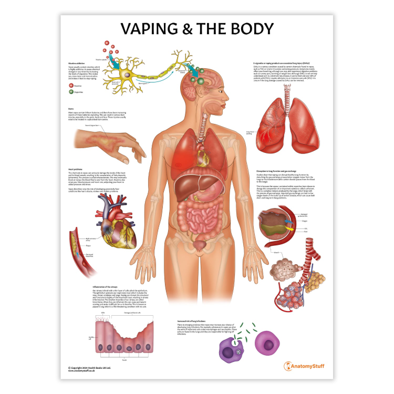 Vaping and the Body Poster | E-Cigarette Health Effects Chart AnatomyStuff Vaping and the Body Poster | E-Cigarette Health Effects Chart AnatomyStuff