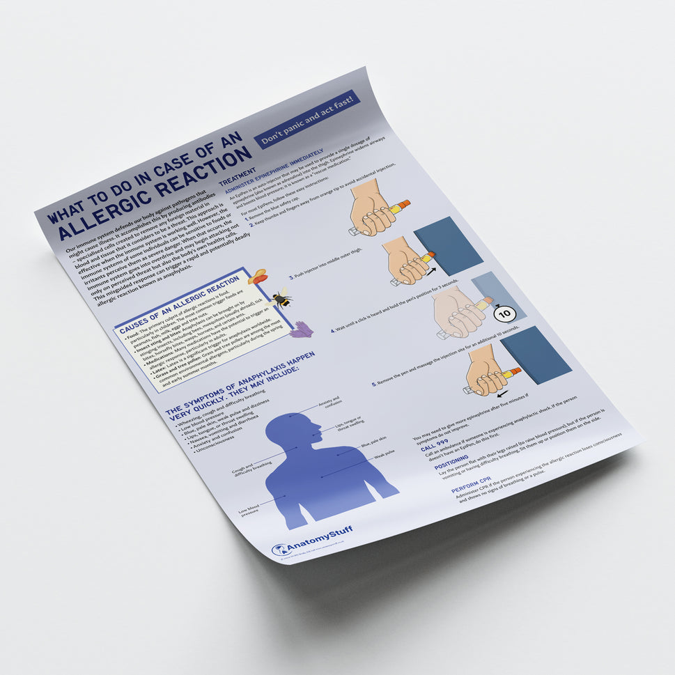 What to Do In Case of An Allergic Reaction Chart / Poster