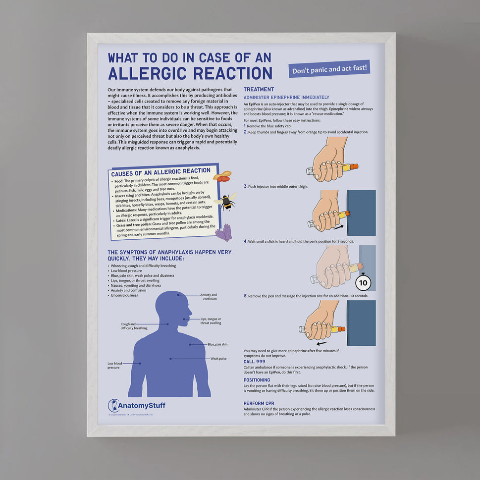 What to Do In Case of An Allergic Reaction Chart / Poster