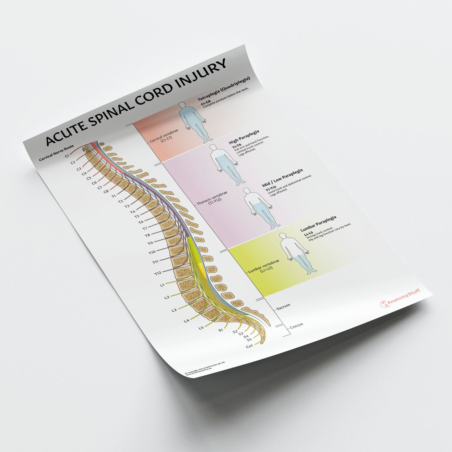Acute Spinal Cord Injury Chart / Poster
