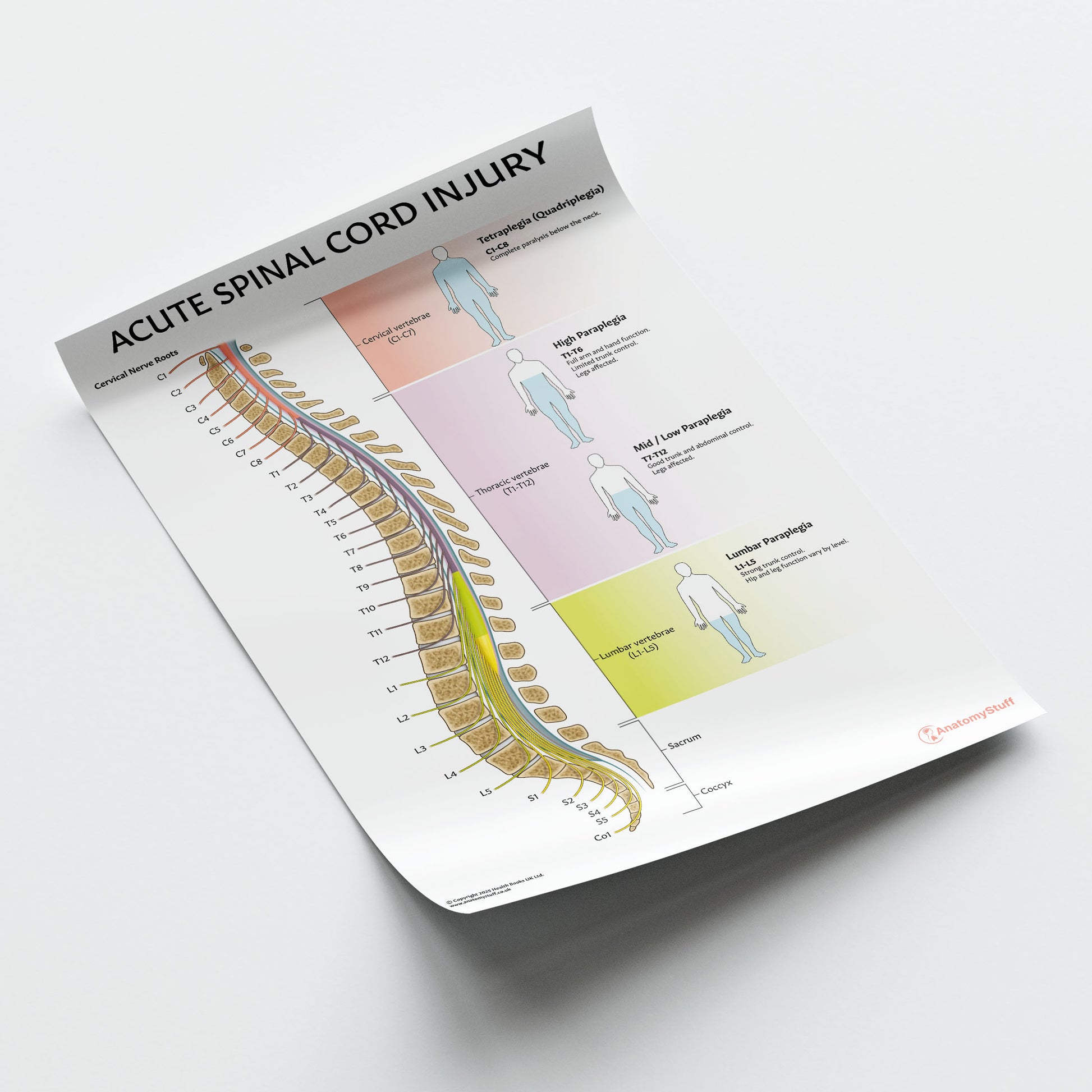 Acute Spinal Cord Injury Chart / Poster