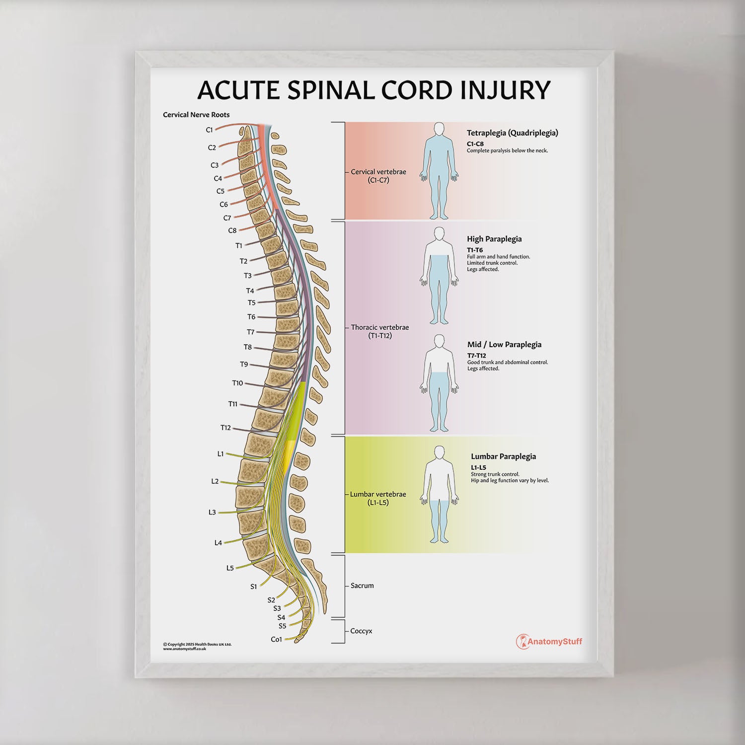 Acute Spinal Cord Injury Chart / Poster
