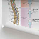 Switch Acute Spinal Cord Injury Chart / Poster 2 image