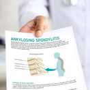 Switch Ankylosing Spondylitis Handout 2 image