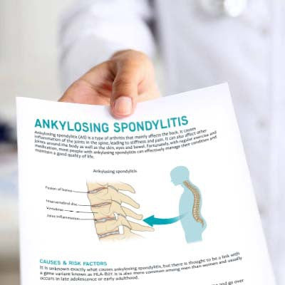 Ankylosing Spondylitis Handout