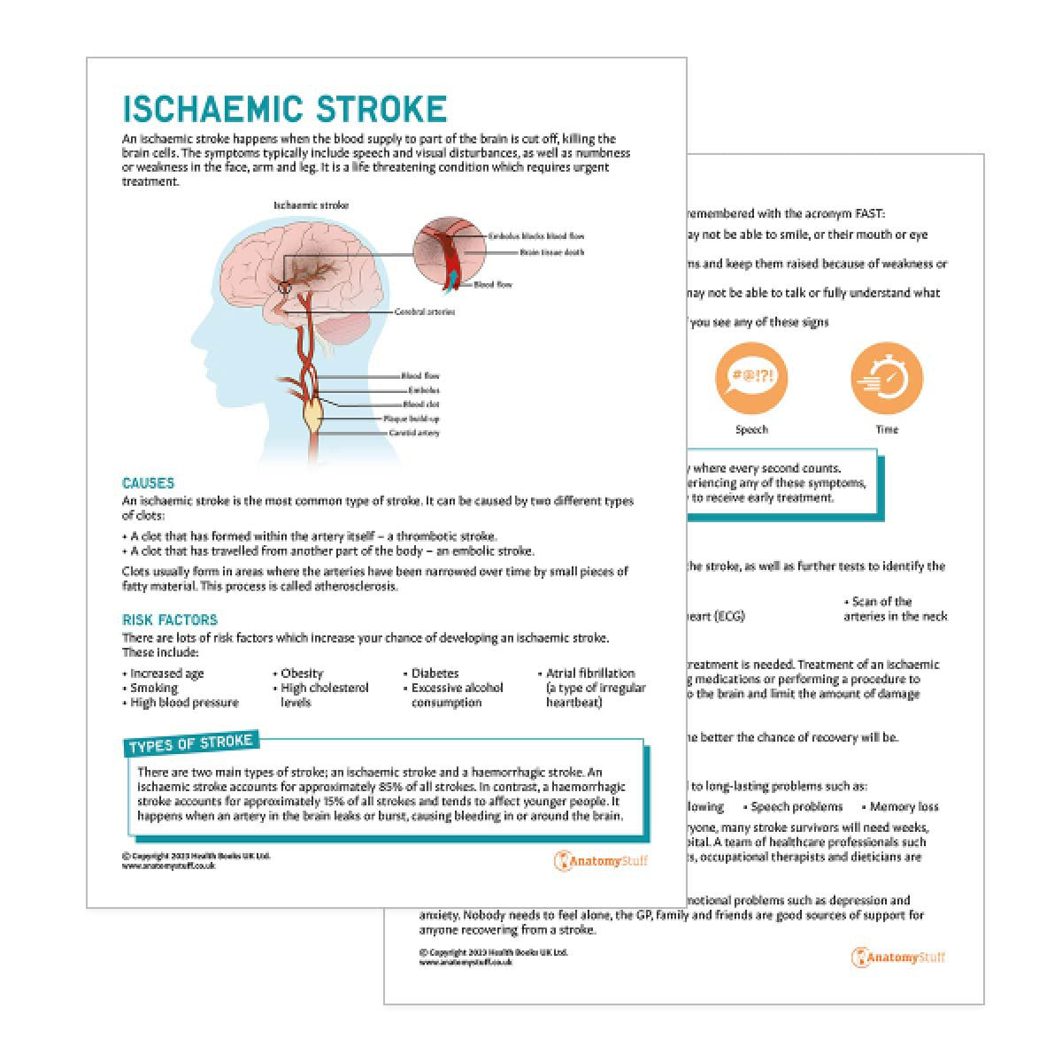 Ischaemic Stroke Patient Education Handout (Printable PDF)