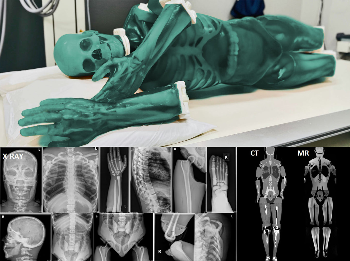 FLB04 Adult Full Body manikin, for  X-Ray/CT and Ultrasound, with muscles
