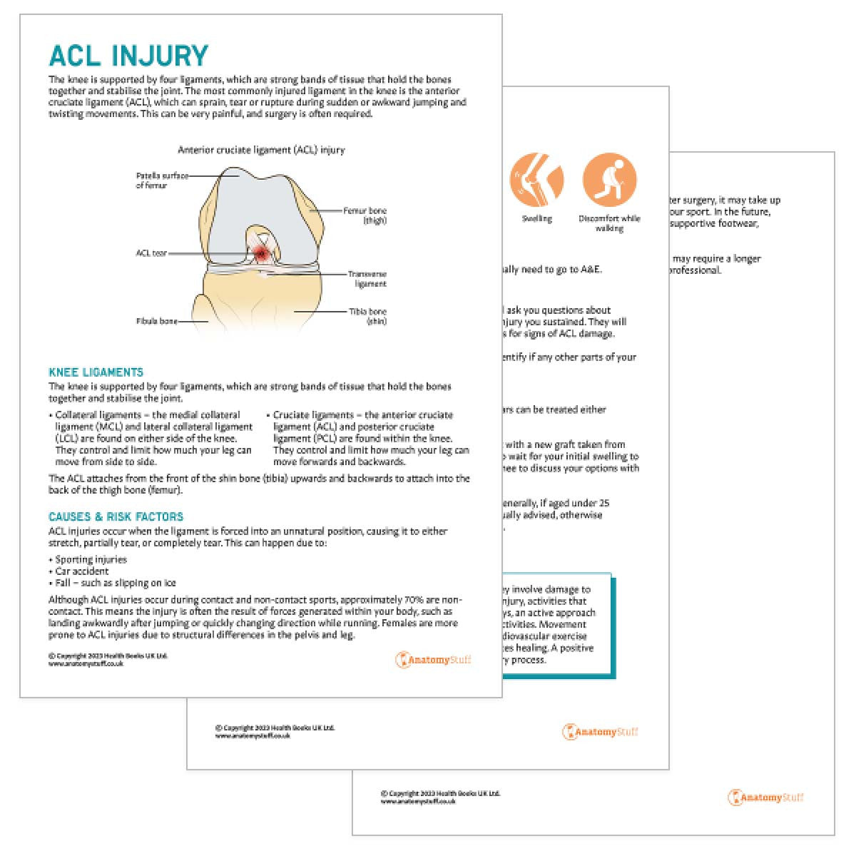ACL Injury Patient Education Handout