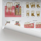 Switch Dental Diseases &amp; Disorders Chart / Poster 2 image