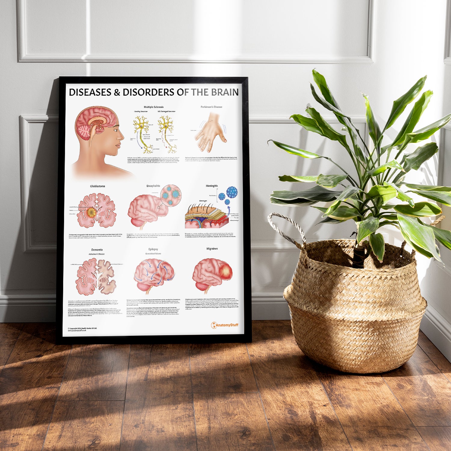 Brain Disease Anatomy Poster | Common Brain Disorders Chart – AnatomyStuff