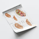 Switch Ear Reflexology &amp; Acupuncture Chart / Poster 3 image
