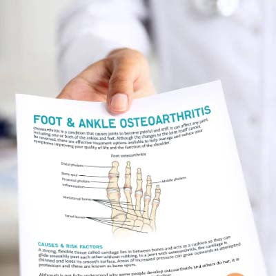 Foot & Ankle Osteoarthritis Patient Education Handout (Printable PDF)