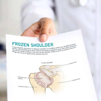 Frozen Shoulder Patient Education Handout (Printable PDF)