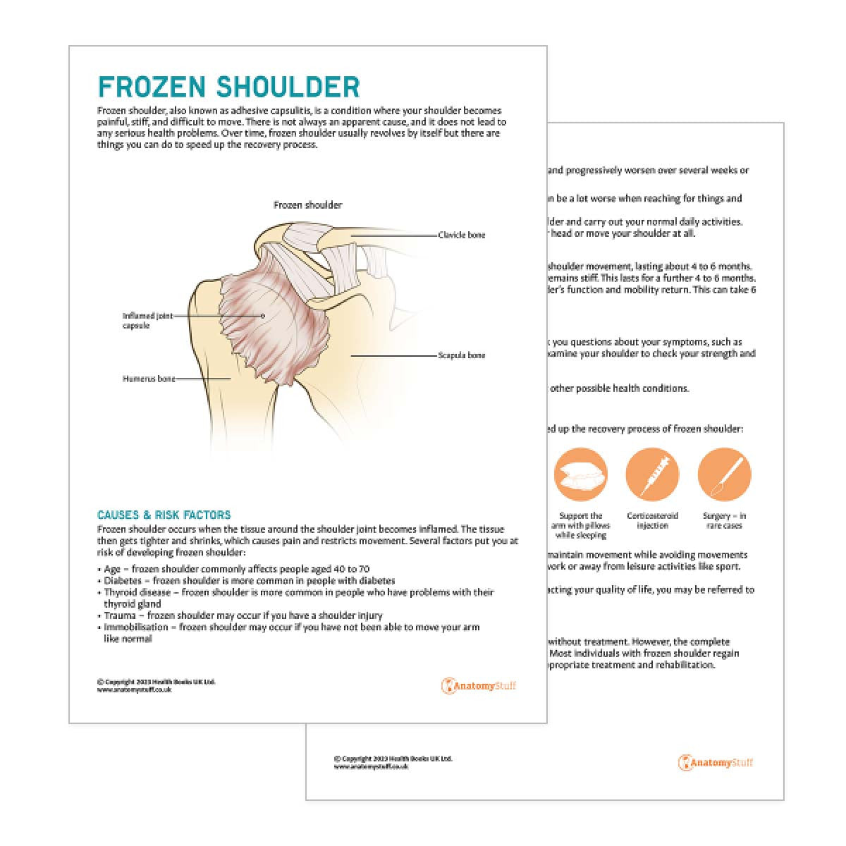 Frozen Shoulder Patient Education Handout (Printable PDF)